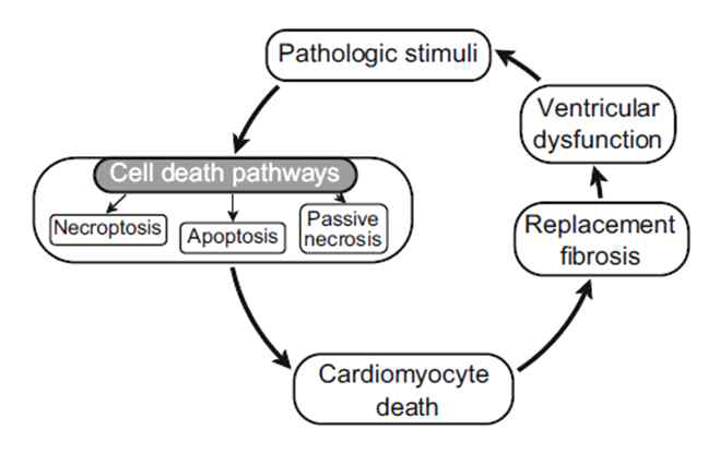 심부전질환과 심근세포사멸의 관계
