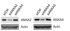 EF에서 Annexin A (ANXA)의 knockdown 확인