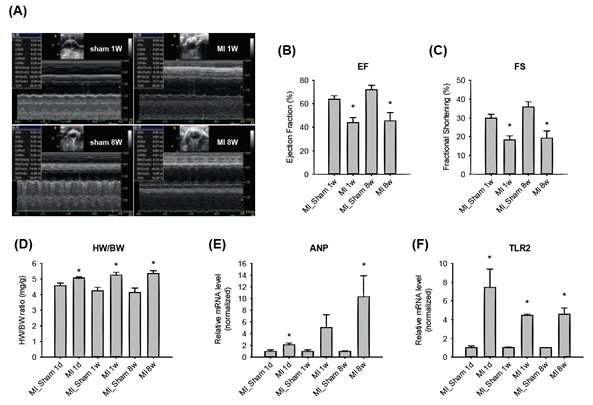 허혈성 심부전 동물모델의 심장 기능 및 심장 크기. 수술을 수행한 지 1일, 1주, 8주 (각각 급성, 대상성, 만성) 후에 심장초음파 (A)를 수행하여 심장 기능 (B-C)을 확인하고, 체중 및 심장무게 (D), 심부전 마커(E-F)를 측정함. (급성 MI 수술의 경우, 수술 부위 봉합사로 인해 심장초음파 불가하여 데이터 없음)