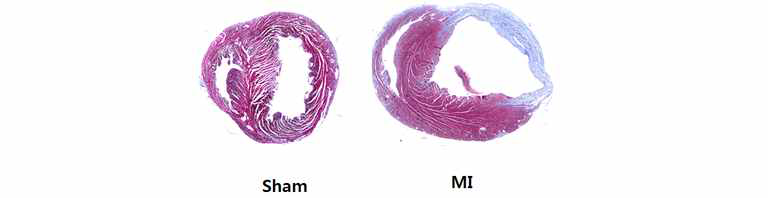 허혈성 만성심부전 동물모델의 심장 조직 염색을 통한 심근섬유화 측정. 심근섬유화가 진행된 부분은 파란색으로 염색됨