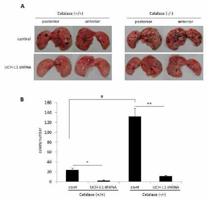 Catalase (+/+), catalase (- /- ) 마우스에 대한 UCH- L1 발현양이 다른 B16F10 세포주의 pulmonary metastasis 경향
