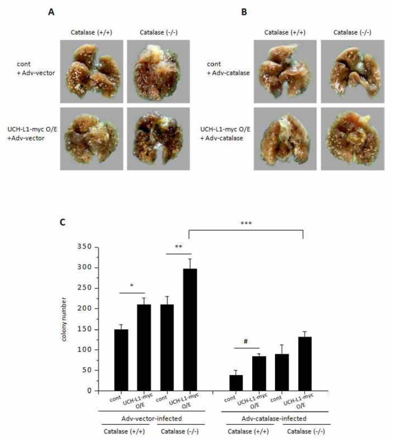 UCH-L1에 의해 유도된 활성산소종이 catalase(+ /+ ) 또는 catalase(- /- ) 마우스로의 pulmonary metastasis에 미치는 영향