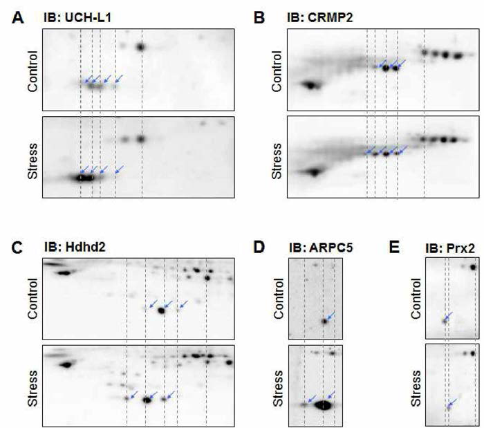 2DE-western blotting으 로 spot이동을 보이는 단백질을 확인하였다. (A) UCH- L1 (Ubiquitin C terminal hydrolase L1) (B) CRMP2 (Dihydropyrimidinase-related protein 2) (C) Hdhd2 (Haloacid dehalogenase-like hydrolase domain-containing protein 2) (D) ARPC5 (Actin-related protein 2/3 complex subunit 5) (E) Prx2 (Peroxiredoxin-2)