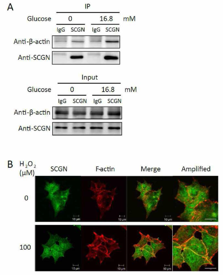 Glucose 자극에 의해 SCGN-actin의 상호작용이 증가하고 (A), 주로 세포막에서 상호작용이 주로 일어남을 확인할 수 있음 (B)