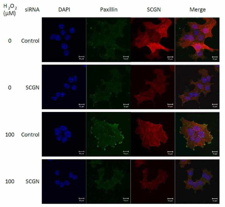 H2O2 처리에서 focal adhesion이 증가하나 SCGN이 knock down 되는 경우 이 focal adhesion이 크게 감소함을 보여줌