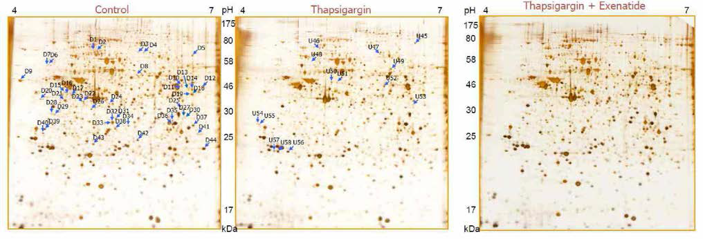 2-PAGE analysis of INS-1 cell treated with control, Tg and Tg combined with exenatide treatment
