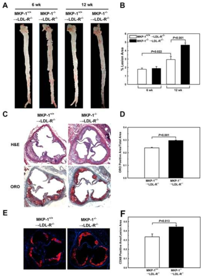 MKP-1 deficiency in macrophages promotes atherosclerosis. Bone marrow transplantation was performed in LDL-R−/− mice using wildtype and MKP-1−/− mice as bone marrow donors. Mice were fed a high-fat diet for 6 and 12 wk. Hearts and aortas of bone marrow recipients were removed, and the size of atherosclerotic lesions was determined by en face analysis (A+B) and Oil Red O– stained sections from the aortic roots (C+D). Experiments were performed using 5–10 mice per experimental group. Macrophage contents in the atherosclerotic aortic roots was assessed by analysis of CD68-stained sections from the aortic root (E+F)