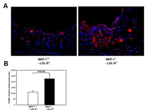 Both MKP-1-deficient macrophages are sensitized to oxysterol-induced apoptosis. Cell death in the atherosclerotic aortic roots of mice that received either wildtype or MKP-1−/− bone marrow and were fed a high-fat diet for 12 wk was assessed by TUNEL-positive cells relative to the atherosclerotic lesion area (E+F). Experiments were performed using 5–8 mice per experimental group (MKP-1+/+ → LDL-R−/−: n = 5; MKP-1−/− → LDL-R−/−: n = 8). Results are shown as mean ± SE