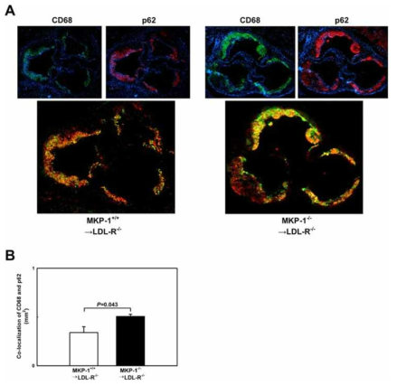 Loss of MKP-1 activity impairs macrophage autophagy in atherosclerotic lesions. (A+B) Autophagy in the atherosclerotic aortic roots of mice that received either wildtype or MKP-1−/− bone marrow and were fed a high-fat diet for 12 weeks was assessed by immunofluorescence. The autophagy marker p62/SQSTM1 (red) was concurrently imaged with CD68 (green). Experiments were performed using 5 mice per experimental group. Results shown are mean ± SE
