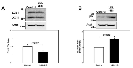 Metabolically primed macrophages exhibit defective autophagy. Autophagic activity was assessed by Western blot analysis as the ratio of LC3-II to LC3-I and p62/SQSTM1 levels in unprimed (Control) and metabolically primed (LDL+HG) mouse peritoneal macrophages. Results shown are mean ± SE of 3 independent experiments