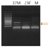 Gene expression of FGF isoform in human hair follicle (57M, 57 year old male; 23F, 23year old femle; M, melanocyte)