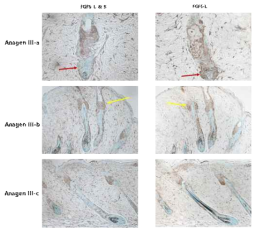 Immunoreactivity for FGF5 long and short form in mouse hair follicles (FGF5 L FGF5-L, FGF-5 short form)