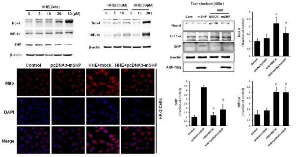 HK-2 cell에서 SHP의 발현 변화 양상, SHP 과 발현 후 Nox4, HIF-1 alfa 변화 및 mitotracker를 이용한 미토콘드리아 ROS 생성 확인