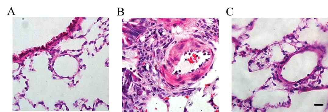 Monocrotaline(MCT)으로 유도된 폐동맥 고혈압 동물의 폐세동맥 형태 변화와 sargacromenol D의 완화 효능. 대조군(A), MCT 투여군(B), MCT 투여 후 sargacromenol 처치군(C)에서 동물 개체를 포르말린으로 관류 한 후 파라핀 블록 제작. 5 μm 두께로 절편을 제작한 후 hematoxylin-eosin 염색. Scale bar는 20 μm