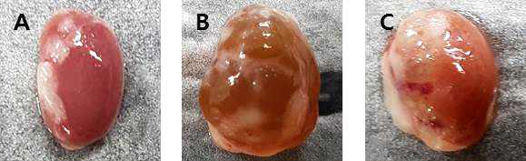 대조군 신장(A), diabetic nephropathy(B), 그리고 sargacromenol D를 식이한 당뇨 쥐 모델에서의 신장 변화