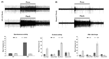 당뇨 유발 후, 척수에서 기록한 발바닥 통증 신호 (Extracellular recording)