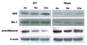 척수에서 MIF, Iba-1, neurofilament 단백질 발현 변화 양상 (Western blot)