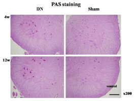 척수에서의 PAS 염색