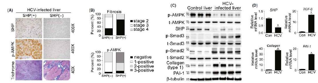 HCV 감염된 환자의 조직에서 섬유화가 증가함을 immuonohistochemical염색, trichrome 염색, western blot, real time RT-PCR analysis를 통해 확인함