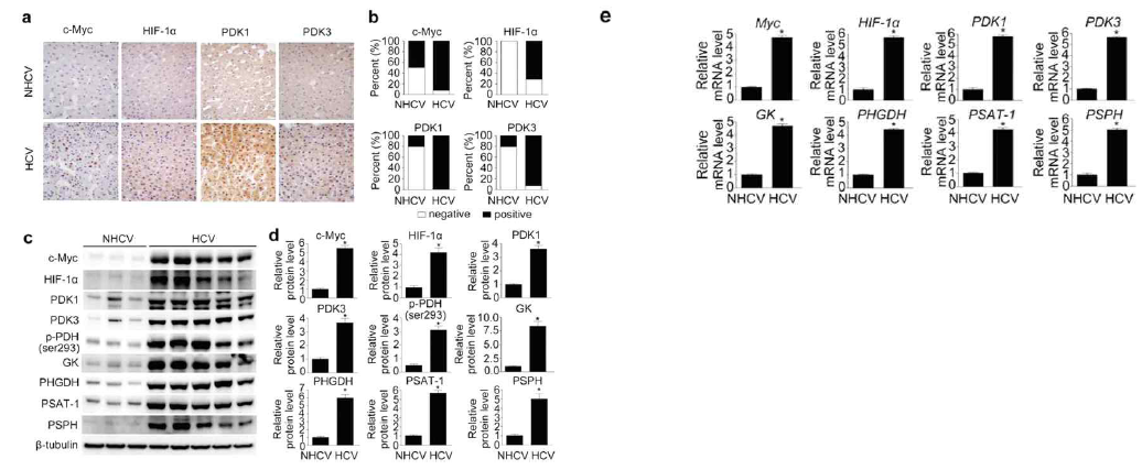 HCV감염된 환자의 간조직에서 c-Myc, HIF-1α, PDK 1과 PDK 3가 증가함을 immunohistochemical염색과 western bolt, real time RT-PCR analysis를 통해 확인함