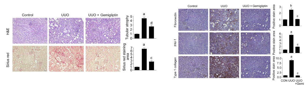 UUO유발 신장 섬유화 동물 모델의 신장손상과 섬유화 변화 관찰