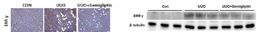 UUO유발 신장 섬유화 동물 모델에서 immunohistochemistry염색과 western bolt analysis을 통한을 통한 ERR gamma 변화 관찰