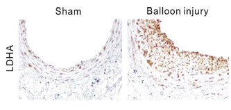 풍선확장술을 통한 동맥경화모델에서 LDHA의 증가를 immunohistochemical 염색을 통해 확인함