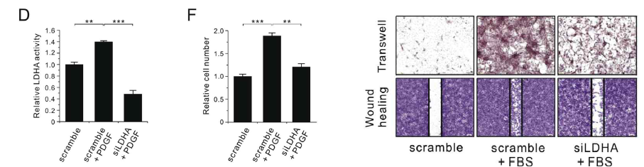 LDHA억제를 통한 혈관평활근세포의 증식과 이주억제를 cell counting, Transwell assay와 wound healing assay를 통해 확인함