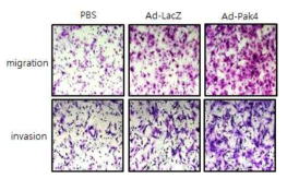 PAK4 과발현시 활막세포의 이동 및 침투