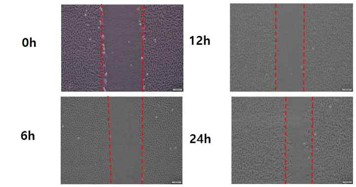 tenocyte culture 및 migration test