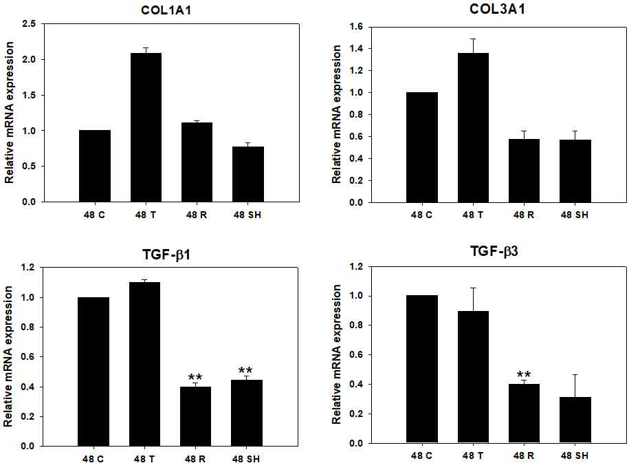 JAK1/JAK2의 억제제 및 STAT5/STAT5 억제제에 의한 colagen 및 TGF-beta의 발현 변화 (48시간). TSLP처리 후 증가한 Collagen 1, Collagen 3, TGF-beta1, TGF-beta3는 ruxolitinib 및 SH-4-54 처리 48시간 후 유의하게 감소하는 양상을 보임