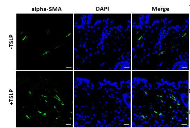 TSLP 마우스 진피하 주사 시 myofibroblast의 증가. 마우스에 TSLP 진피 주사 시 섬유화와 깊은 연관이 있는 myofibroblast의 수가 증가함