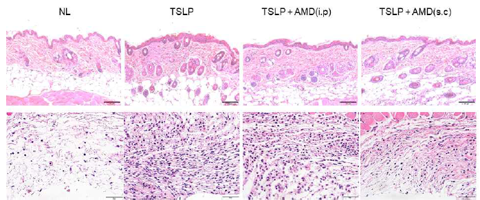 H&E 염색 소견 TSLP 의해 피부 조직 내 세포 침윤이 현저히 증가되며, AMD3100에 의하여 감소됨