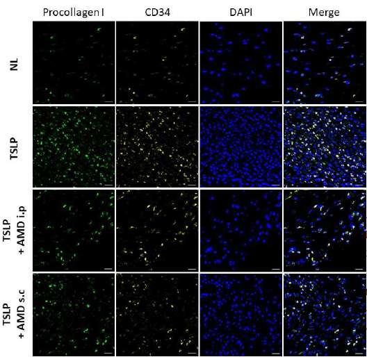 면역형광염색 소견 Flow cytometry결과와 마찬가지로 TSLP 의해 피부 조직 내 CD34+procollagen1+ fibrocyte의 침윤이 현저히 증가되며, AMD3100에 의하여 감소됨