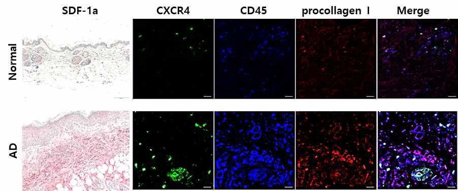 SDF-1a의 발현 증가 및 fibrocyte 의 침윤 증가. NC/Nga 마우스의 아토피피부염 유발 시 피부 조직에서 SDF-1a의 발현 및 fibrocyte의 침윤이 증가함