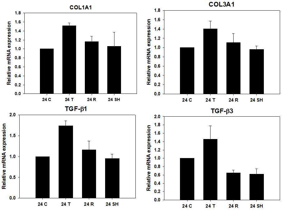 JAK1/JAK2의 억제제 및 STAT5/STAT5 억제제에 의한 colagen 및 TGF-beta의 발현 변화 (24시간). TSLP처리 후 증가한 Collagen 1, Collagen 3, TGF-beta1, TGF-beta3는 ruxolitinib 및 SH-4-54 처리 24시간 후 감소하는 양상을 보임