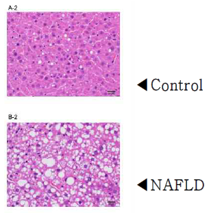 Representative histopathology of liver sections from control and NAFLD rats