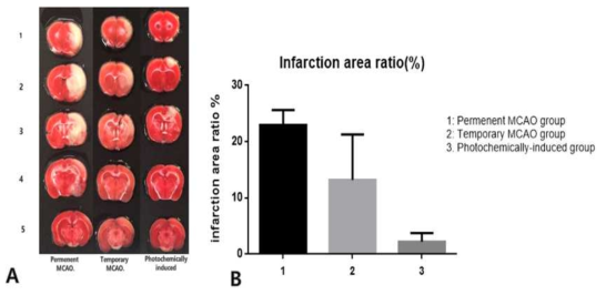 TTC Staining (A) and infarction area (%)