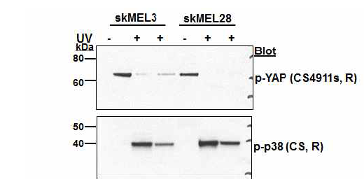 The expression of p-YAP and p-p38 in melanoma cell line (skMEL3, skMEL28, and A375) UVC (254nm) 를 0.02J/cm2으로 처리한 전후 YAP의 발현을 비교함. UVC 처리 이후 skMEL3와 skMEL28 에서 p-YAP의 발현은 감소하였으나 p-p38의 발현은 증가하였음