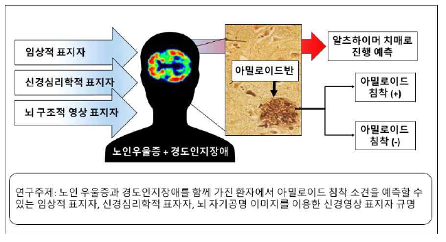 노인우울증과 경도인지장애를 함께 가진 노인에서 뇌 아밀로이드 침착을 이용한 치매를 예측