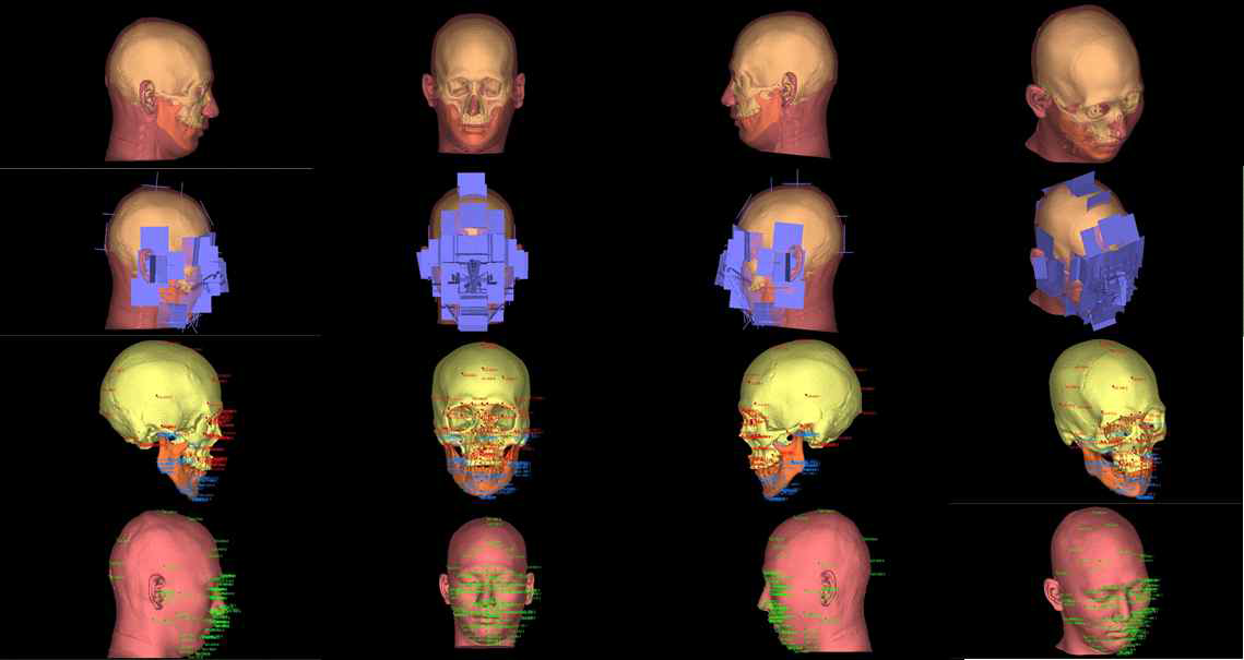 머리뼈 및 얼굴 3차원 모델과 표지점. 표지점의 위치 검증은 평면을 이용함