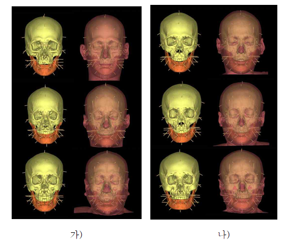 구축한 피부자료를 이용한 얼굴복원과 실제 얼굴 비교 가) 남자 머리뼈 나) 여자 머리뼈