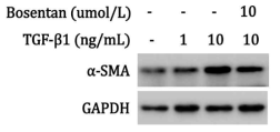 alpha SMA expression in TGF beta and bosentan treated HK-2 cells