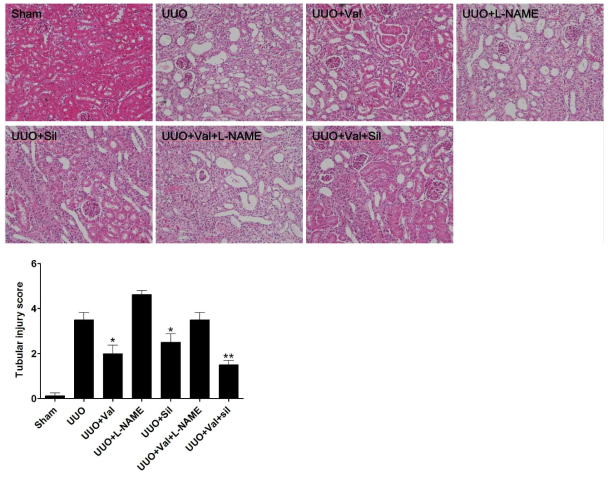 H & E stain in UUO and sham kidney sections. L-NAME treatment aggravated the renal injury. valsartan and sildenafil co treatement improved the UUO induced renal injury