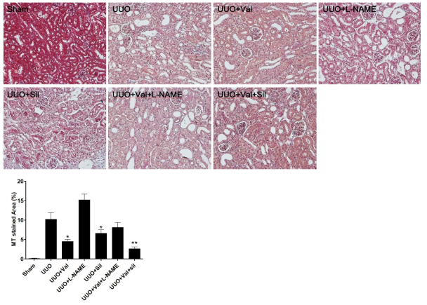 MT stain in UUO and sham kidney sections. L-NAME treatment aggravated the renal fibrosis. Valsartan and sildenafil co treatement improved the UUO induced renal fibrosis