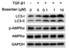 autophagic marker and APMK phophorylation in TGF beta and bosentan treated - HK2 cell