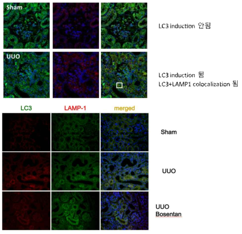 LC3 inluction (LAMP1 colocalization) in UUO mice