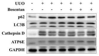 Autophagic flux marker in UUO and UUO with bosentan treated mice