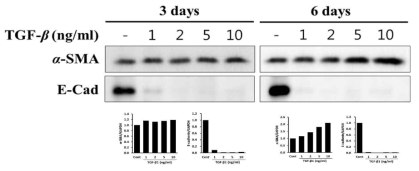 alpha SMA and E-cadherin expression in TGF-beta treated HK-2 cells