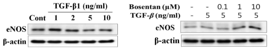 eNOS expression in TGF beta and bosentan treated HK2 cells